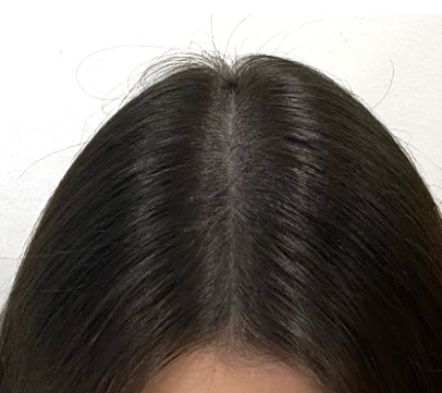 After